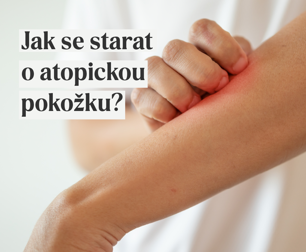 Jak se starat o atopickou pokožku?