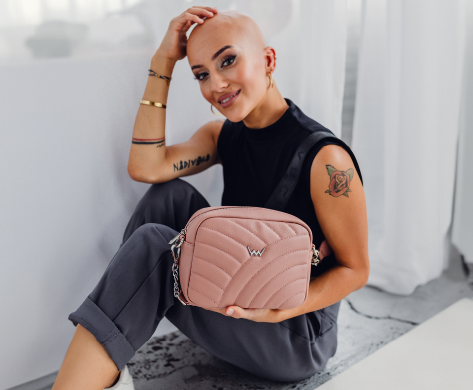 Plešatá žena s onemocněním alopecie universalis
