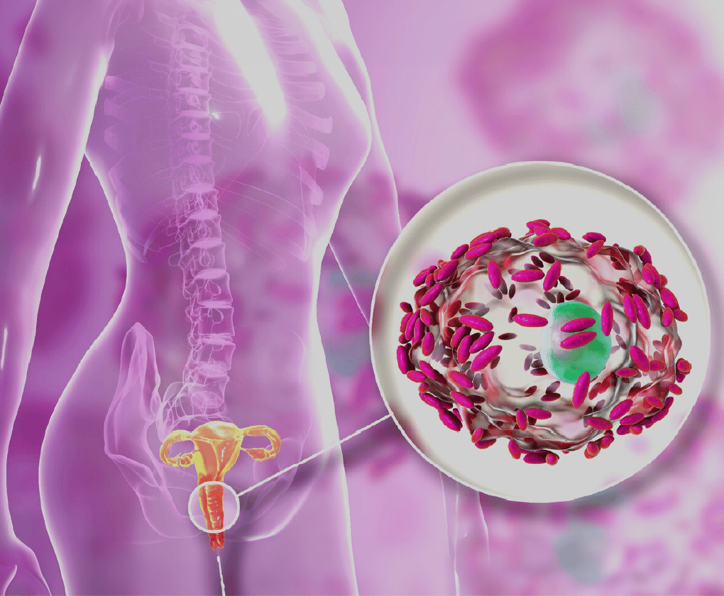 Infografika vaginálního mikrobiomu – rovnováha a dysbioza laktobacilů u žen vizuálně