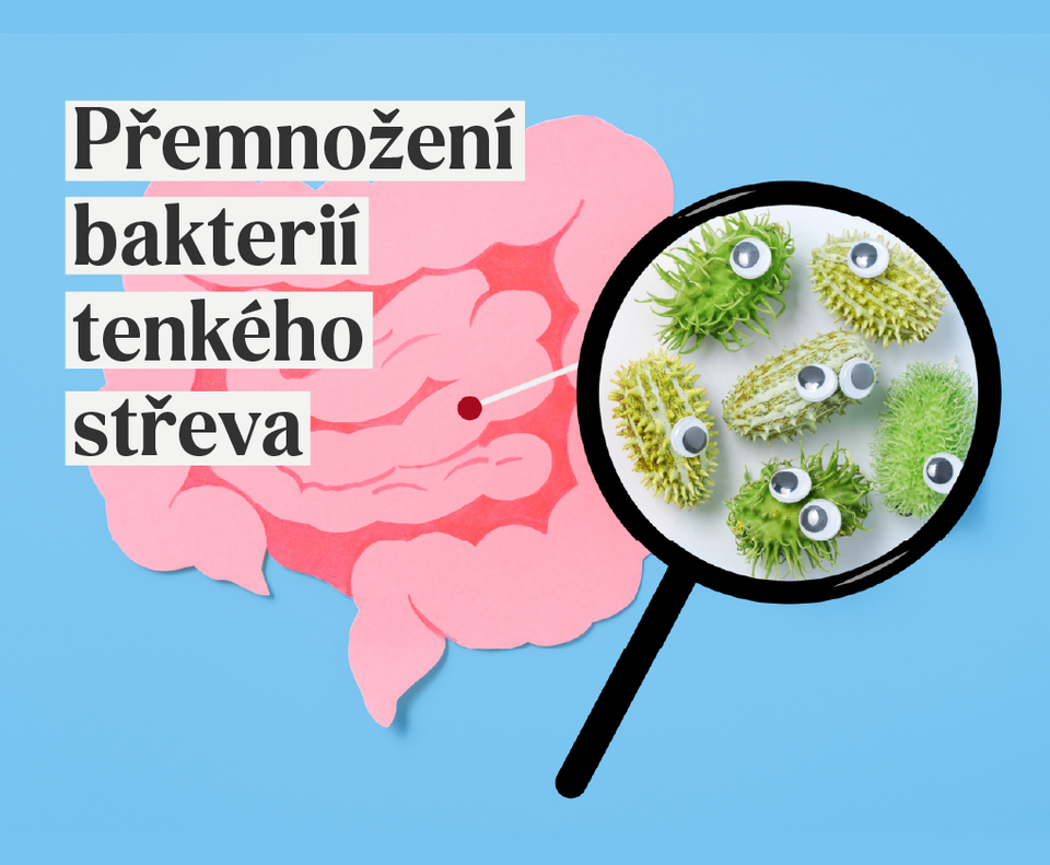 Diagram přerůstání bakterií v tenkém střevě – vizualizace SIBO procesu a jeho příčin