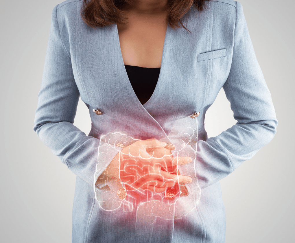 Funkční medicína a IBS – holistický diagram přístupu k syndromu dráždivého tračníku