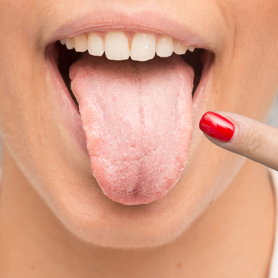 Snímek kvasinky Candida albicans – vizualizace kandidy zvětšené pod mikroskopem