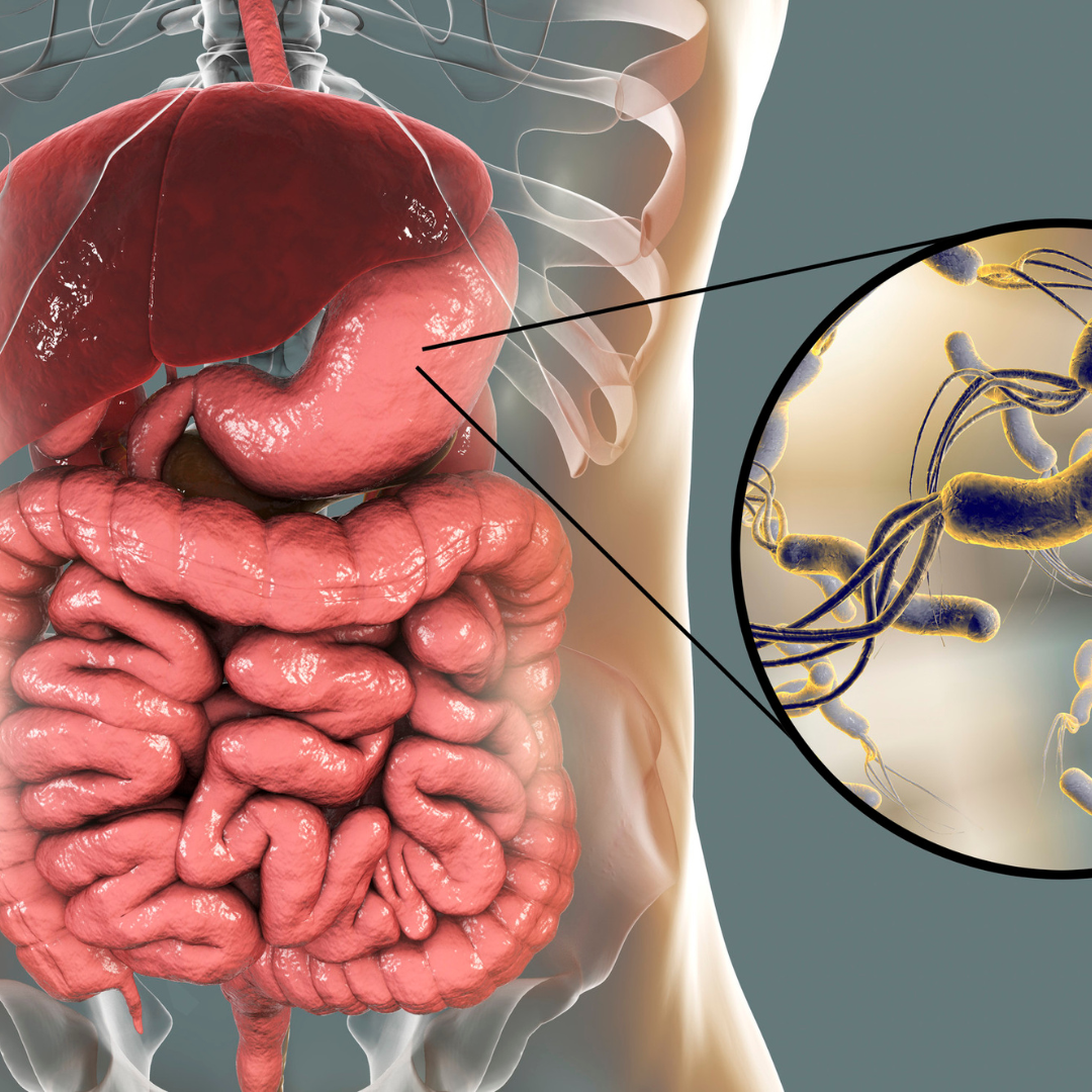 Mikroskopický snímek bakterie Helicobacter pylori v žaludeční sliznici — zobrazení infekce