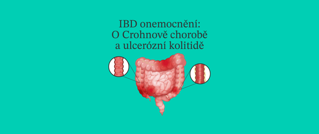 Gastroenterológ o IBD ochoreniach: Crohnova choroba a ulcerózna kolitída